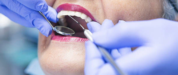 Best Cosmetic Emergency Dentistry in Cleveland, FL
